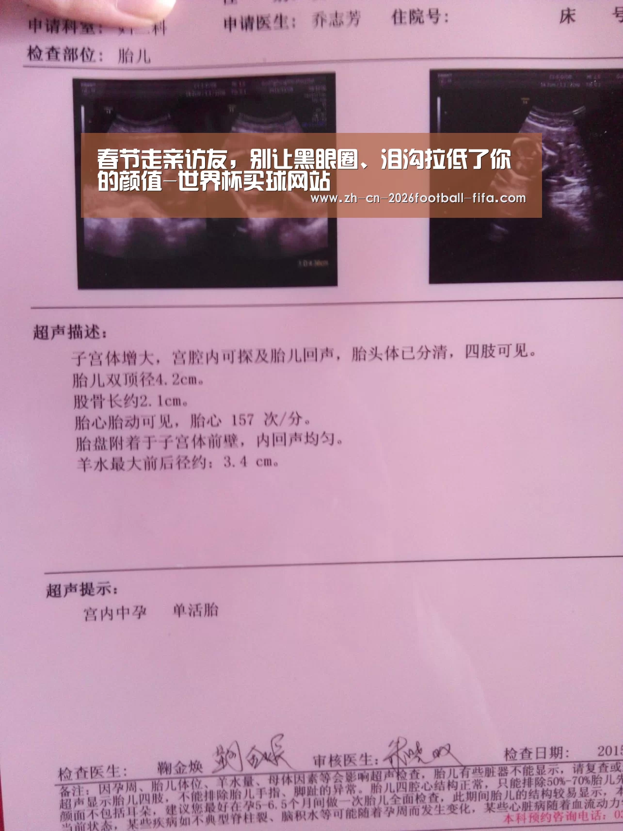 春节走亲访友，别让黑眼圈、泪沟拉低了你的颜值-世界杯买球网站